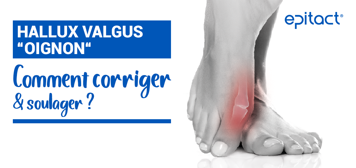 Hallux valgus : définition, symptômes, etiologie, solutions