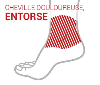 Entorse cheville douloureuse