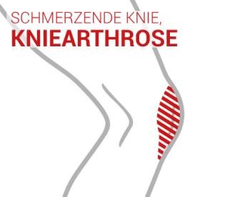 KNIEARTHROSE