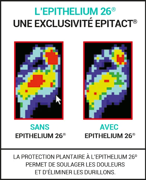 Protection de l'Hallux Valgus + Douleurs plantaires