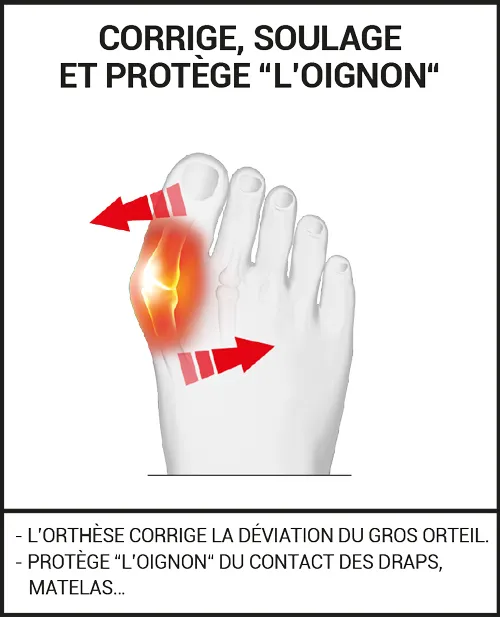 Orthèse Hallux Valgus Nuit