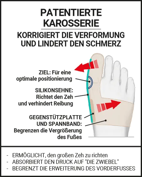HALLUX-VALGUS-KORREKTURORTHESE 